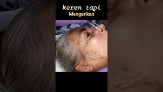 Ngeri perawatan wajah pengangkatan sel kulit mati #shorts #skincare #perawatanwajah #wajahawetmuda