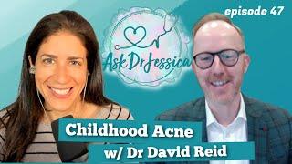 Dealing with Acne (For Kids!) w/ Dr. David Reid - Ask Dr Jessica