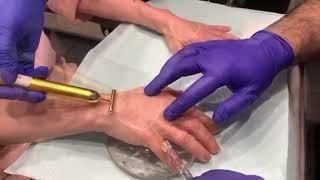 HAND REJUVENATION