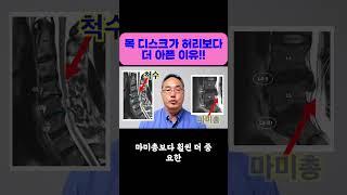 목 디스크가 허리보다 더 아픈 이유