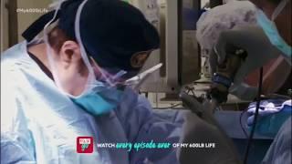 My 600-lb Life • Dr. Nowzaradan Performs A Weight Loss Surgery (720p)