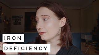 WHAT PEOPLE DON'T TELL YOU ABOUT IRON DEFICIENCY (SYMPTOMS + HOW I FOUND OUT)