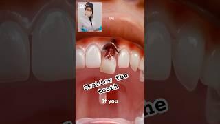 Swallow the Tooth accidentally!