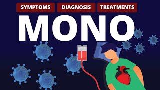 What is MONO?  Symptoms, Diagnosis & Treatments