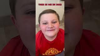 This is me in 2022￼