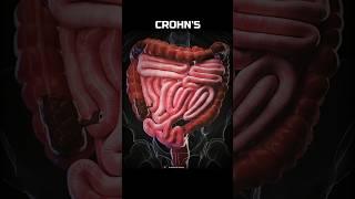 Diseases, that have no cure till now! #Shorts #Biology #Science #Organs #Disease