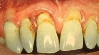 Water Brook Dental Periodontal Therapy