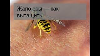 Жало осы — как вытащить