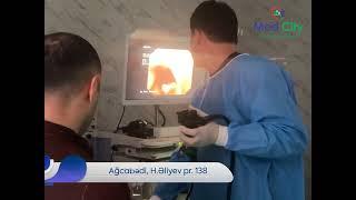 Qastroenteroloq - Hepatoloq ️Dr. Səlimzadə Tural Med City Regional klinikada.