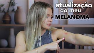 Atualizações sobre o Melanoma