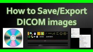 How to Save DICOM images ️ #howto