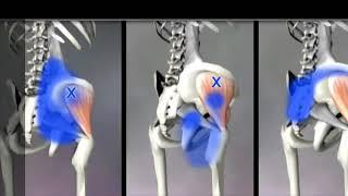 Collagen injection around the hip Dr. Mavropoulos Rodion