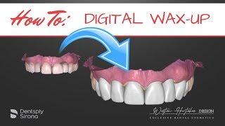 The way of Digital Wax-ups using InLab 18