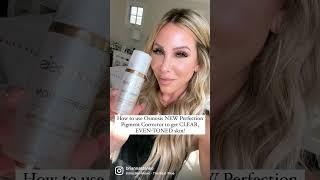 GOOD-BYE HYPERPIGMENTATION, MELASMA, ACNE SCARS, SUN DAMAGE!