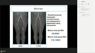 КТ ангиография сосудов нижних конечностей  как собрать данные и не  утонуть  в описании