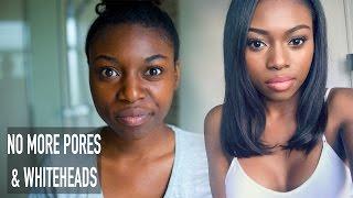 HOW I CLEARED MY SKIN & GOT RID OF LARGE PORES WHITEHEADS & ROUGH TEXTURE