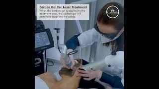 carbon laser facial Mira road Newderma aesthetic clinic