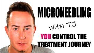 Microneedling Tutorial - Choose Your Own Treatment Journey - Start