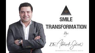 Dental Braces | Invisalign | Clear Aligner | Cosmetic Dental Treatment | Best Orthodontist in India