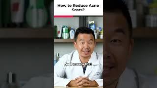 5 Ways To Reduce Acne Scars