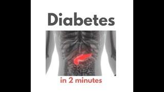 Diabetes Mellitus in under 2 mins!