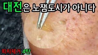 피지 직접 뽑아드렸습니다 ㅡ  대전이 노잼도시 라구요? 아닙니다. 대전은 피지 도시입니다 4탄