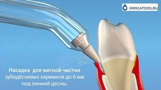 Пародонтологическая насадка Waterpik PP-100E