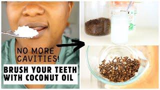 NO MORE CAVITIES IF YOU USE THIS! | OIL PULLING USING COCONUT OIL & CLOVES! NATURAL TOOTHPASTE