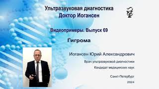 Ультразвуковая диагностика (УЗИ). Доктор Иогансен. Видеопримеры. Выпуск 69. Гигромы.