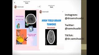 Intro to CT head: high-yield examples with Dr Sam Shuaibi