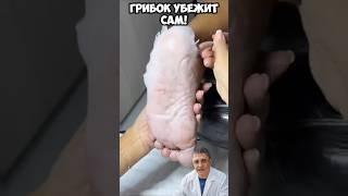 Грибок убежит сам!
