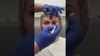 Как правильно колоть Botox.