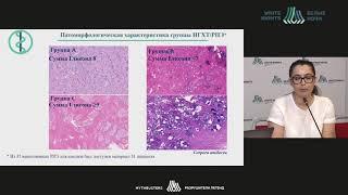 Changes of morph. and immunohistochem. char. of prostate adenocarcinoma during neoadjuvant therapy