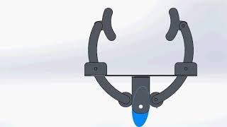 My ventilator concept