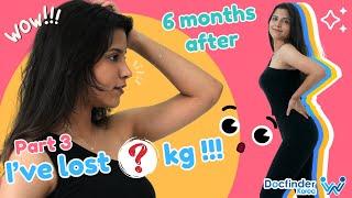 How many kg have I lost since my liposuction in Korea 6 months ago??? Part 3 | Plastic Surgery