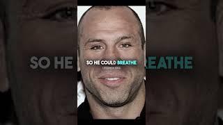 Wanderlei Silva face transformation