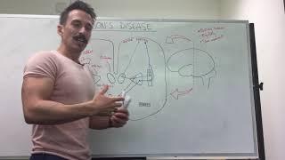 Parkinson's disease | Dopamine and the basal ganglia