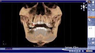 3D xrays- James Klim, DDS, FAGD, AAACD