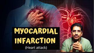 MYOCARDIAL INFARCTION (MI) | Heart attack -in 20mins!