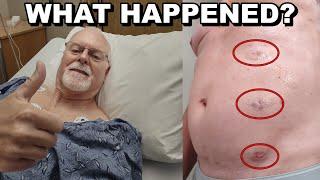 What happened and why I needed surgery