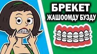 Брекет өбүшкөнгө тоскоол боло берет / менин сырым / кызыктуу окуялар