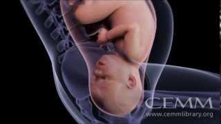 Pregnancyatoz.org: Animated Birth