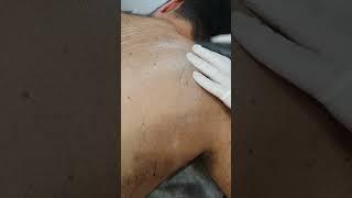 Depilação Masculina Depilação íntima Masculina Lisboa Trimming www.4menclinic.com