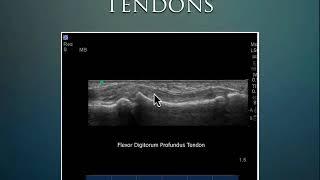 MSK Ultrasound/ tendon/ joints