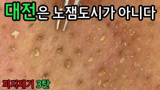 피지 직접 뽑아드렸습니다 ㅡ  대전이 노잼도시 라구요? 아닙니다. 대전은 피지 도시입니다 3탄