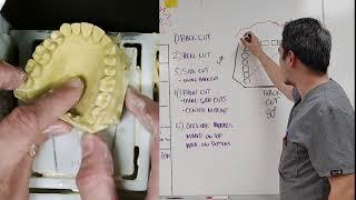 Trimming Study Models - Study, Bleach, and Retainer Casts