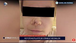 Stirile Kanal D - Fetita mutilata de cainele vecinilor | Editie de seara