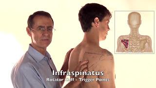 Trigger Point Release - Infraspinatus Muscle