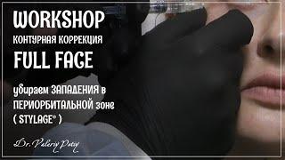 Как убрать западения под глазами Dr.Valeriy Potiy