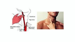 Cardiac Auscultation Made Easy (Heart Sounds), Prof. Khairy Abdel Dayem